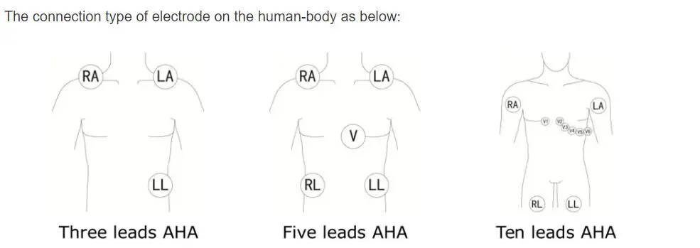 EKG vodiči sa 5 vodiča za Philips digitrak plus 24-satni holter 3100A, 5-olovni, Snap